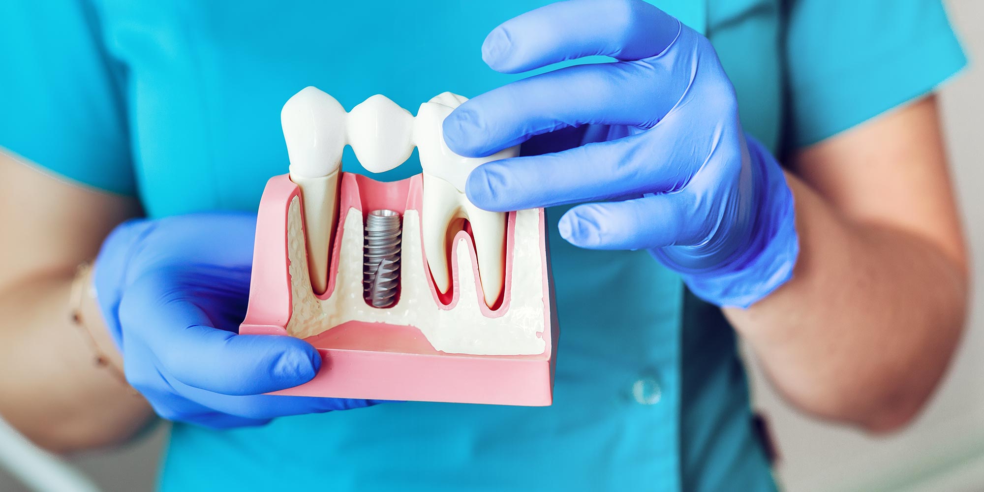 Living with missing teeth? Tooth replacement in Essex