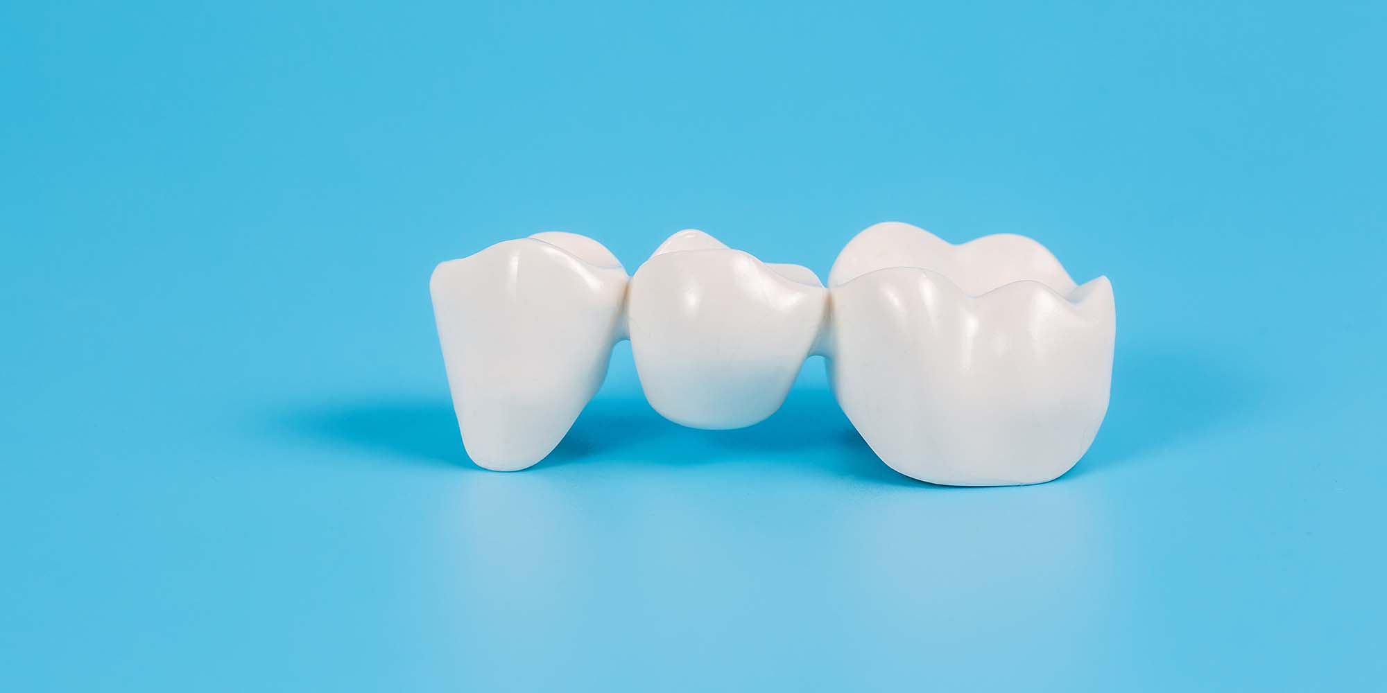 Repair cracked or broken teeth with dental crowns in Essex