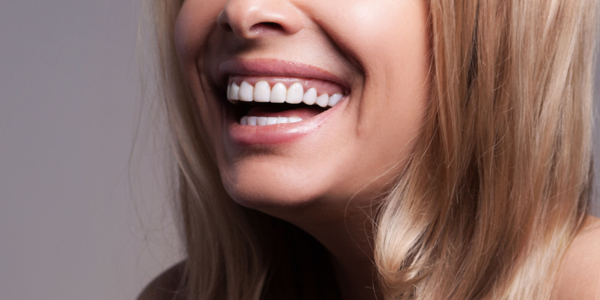 Dental Veneers Costs in Essex